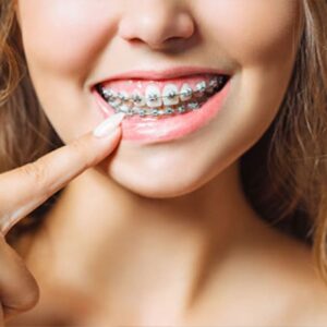 Orthodontics
