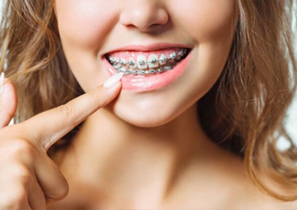 Orthodontics
