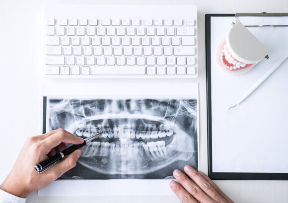 Exam and X-rays