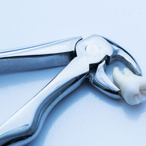 Extractions*