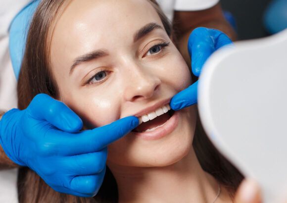 Composite bonding