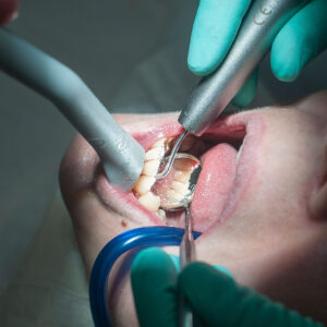 Oral surgery (specialist)