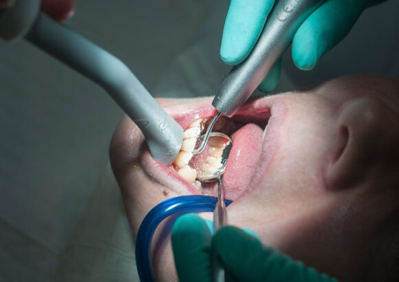Oral surgery (specialist)