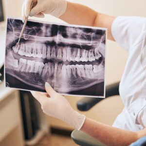 Extractions