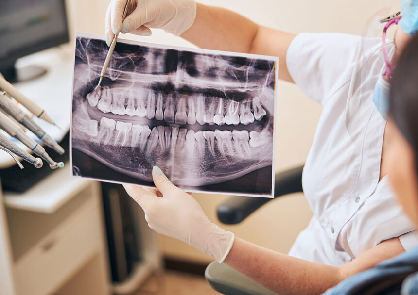patient-dental-education-extractions Extractions