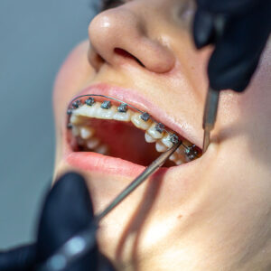 Orthodontics