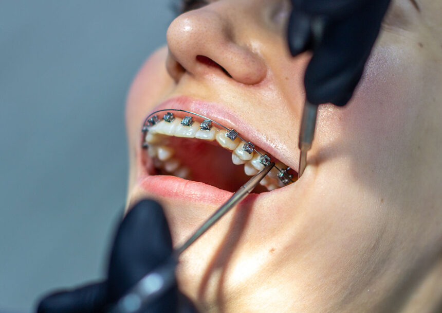 patient-dental-education-orthodontics Orthodontics