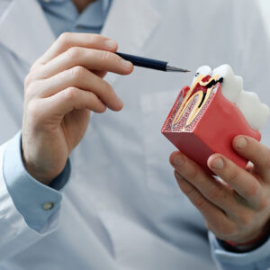 Root Canal Treatment