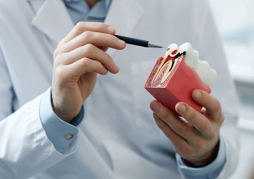 patient-dental-education-root-canal-treatment Root Canal Treatment