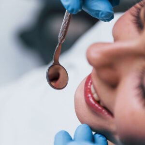 Root canals