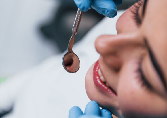 Root canals
